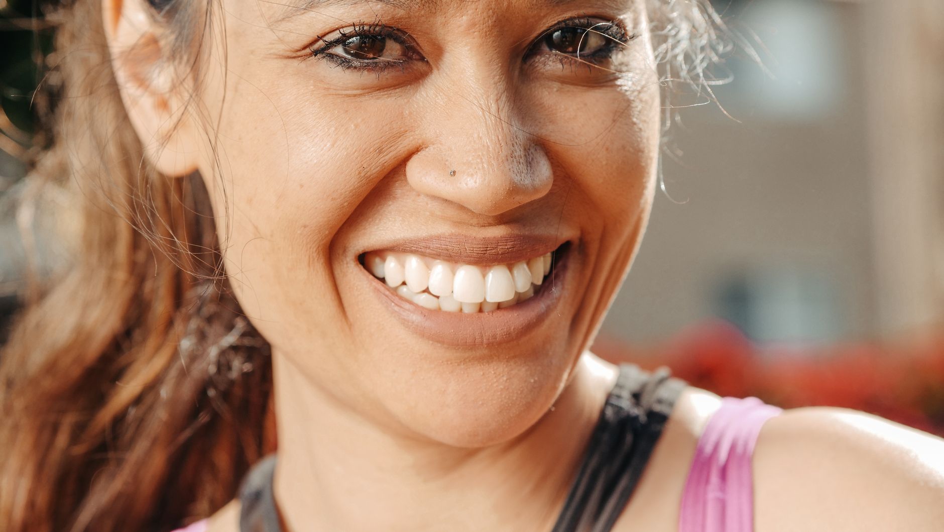 Pinhole Gum Rejuvenation at Korel Dentistry in El Cajon
