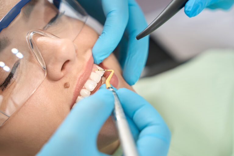 KorelDentistry Elcajon23 rootcanal